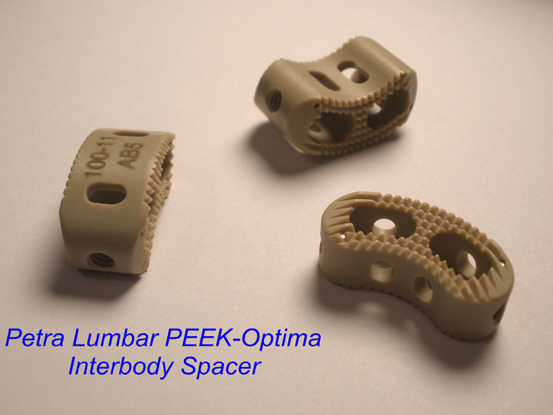 PETRA Lumbar Inter-body Fusion Device
